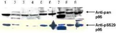 Western Blot: RelA/NFkB p65 [p Ser529] Antibody [NBP1-77808] - pS529 shows phospho p65 staining in carcinoma cells. western blot of total protein lysates from various human head and neck tumors shows phospho p65 staining in tumor cell lines using phospho specific polyclonal anti-human pS529 p65. Lanes 1-6 contain protein lysates from human squamal carcinoma cell lines. Lane 7 is a protein lysate from a primary culture of human keratinocytes. Lane 8 contains protein lysate from ATCC SCC9 cells (also a head and neck squamal carcinoma). Lane 9 contains lysate from EGF-induced human derived A431 cells. Lane 10 (not shown) contains a molecular weight standard. Concurrent staining with anti-beta microtubulin (not shown) was used to confirm equal protein loading in all lanes. HRP conjugated Gt-anti-Rabbit IgG was used to develop the blot using a chemiluminescent detection method.